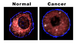 Figure 2: Picture of a healthy and cancerous cell.